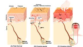 diagrama de fricção na pele por coceira