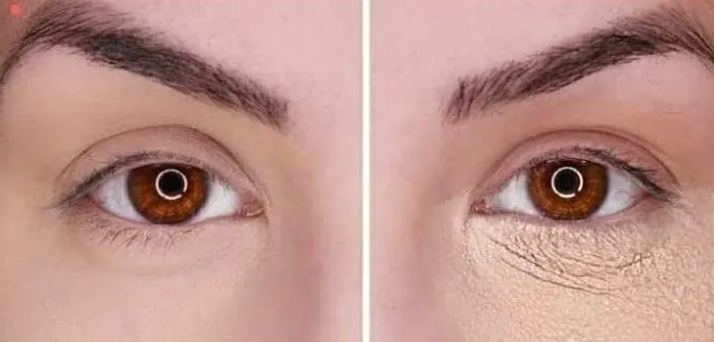 Por que a base craquela? 4 Motivos