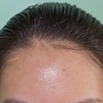 PELE OLEOSA O QUE FAZER? 6 CUIDADOS