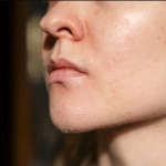 Pele ressecada o que fazer