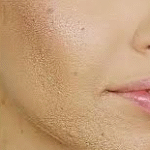 Por que a base craquela? 4 Motivos